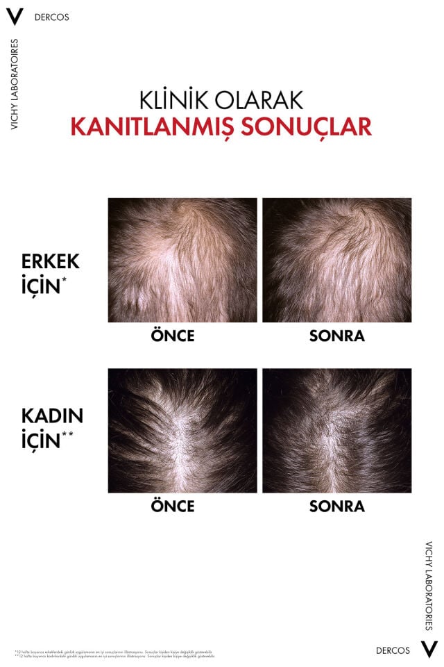 Dercos R.E.G.E.N. Booster Yenilikçi Kadın ve Erkekler İçin Saç Dökülmesine Karşı Bakım Serumu 90 ml