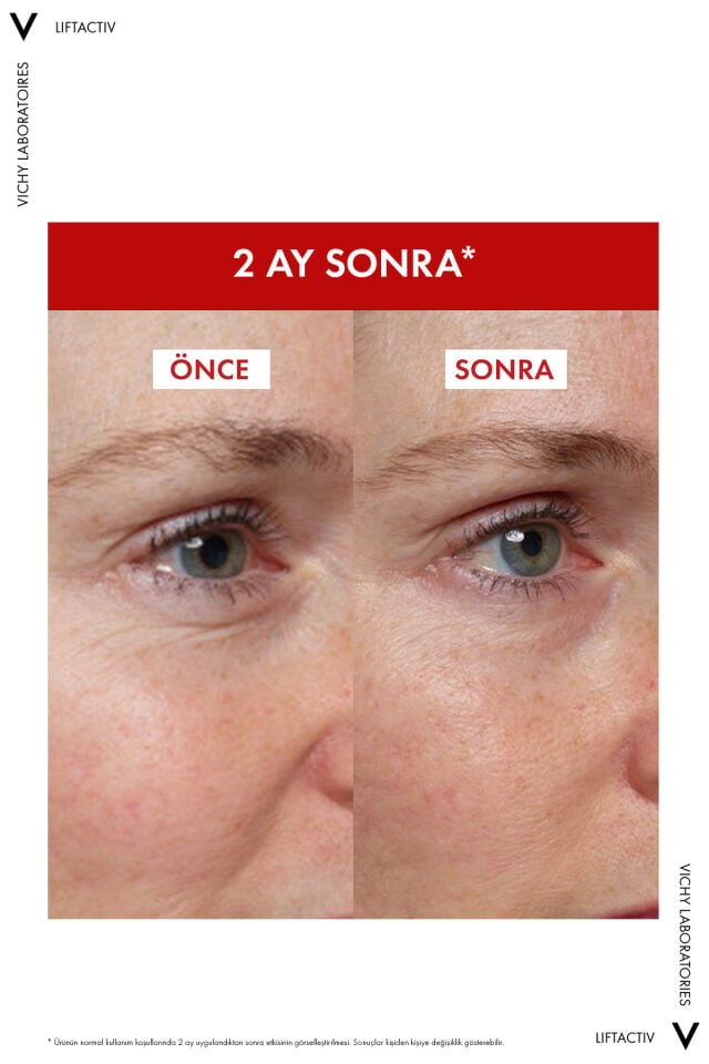 Liftactiv Collagen Specialist 16 Bonding Serum 30ml
